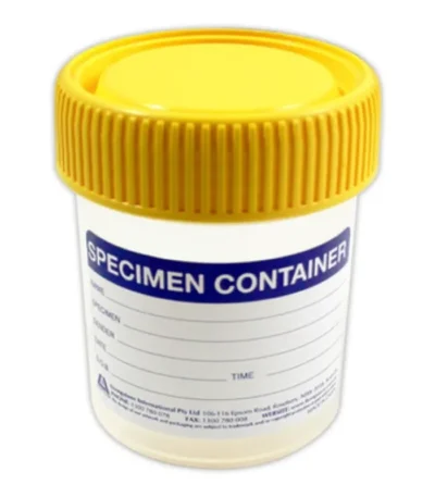 Specimen Sample Container, Urine Jar, 70ml, Clean, Flat Bottom, with Yellow Screw Cap, Labelled, Recyclable Polypropylene (TP5744ULUVN)